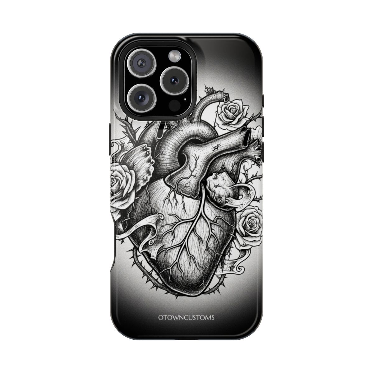 Anatomical Rose Gothic